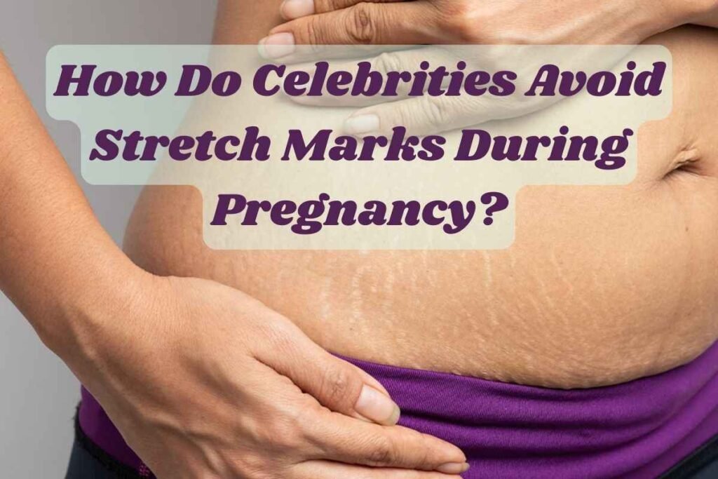 How Celebrities Avoid Stretch Marks During Pregnancy
